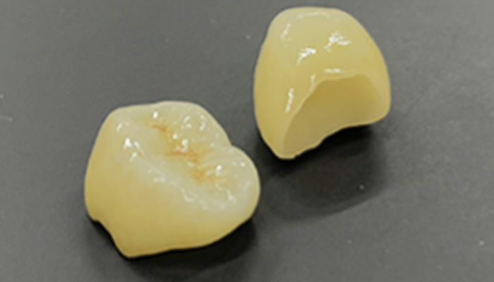 e-max(セラミックス)